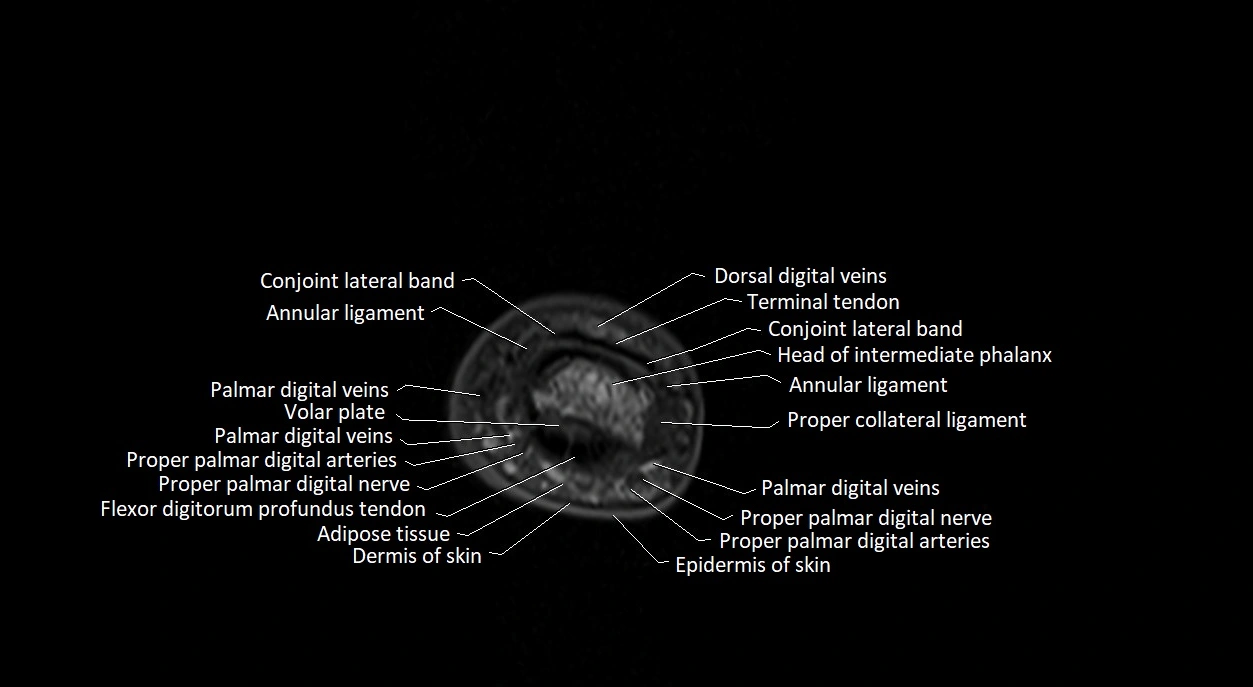 Finger anatomy axial cross sectional 3T image image 7.webp